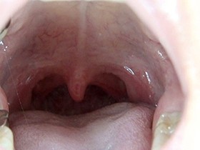 300人のおくち 第1集　サンプル画像09